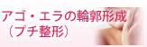 アゴ・エラの輪郭形成(プチ整形)