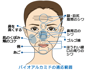 バイオアルカミドの適用範囲