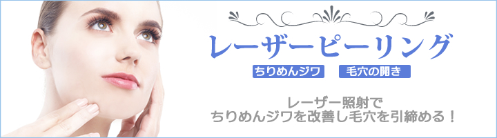 レーザーピーリンング