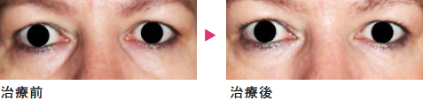 症例2