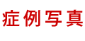 症例紹介