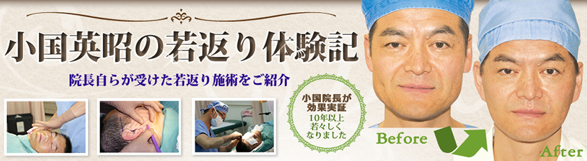 小国英昭の若返り体験記。院長自らが受けた若返り手術をご紹介