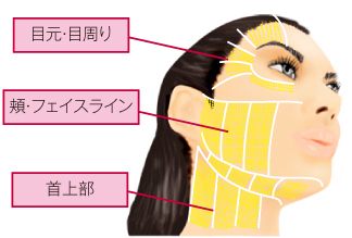 ウルセラの適用範囲