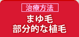 まゆ毛・部分的な植毛